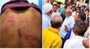 Bijnor में भाजपा विधायक के आवास पर मारपीट के आरोपों की जांच 10 दिन से ठप? दिल्ली के मैक्स अस्पताल में रामू की हालत बिगड़ी, परिवार ने उठाए सवाल